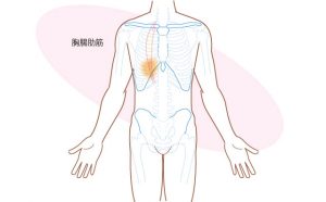 胸腸肋筋のトリガーポイント2