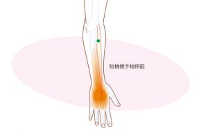 短橈側手根伸筋のトリガーポイント