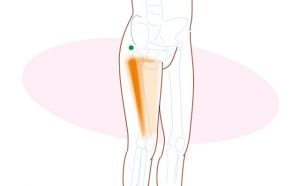 大腿筋膜張筋のトリガーポイント