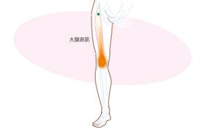大腿直筋のトリガーポイント